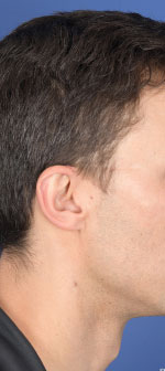 Patient 11-before-image