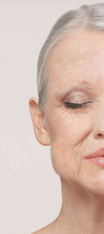 Patient 9-before-image