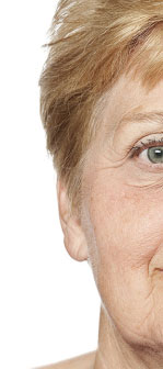 Patient 2-before-image